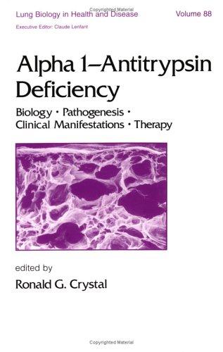 Alpha 1 - Antitrypsin Deficiency