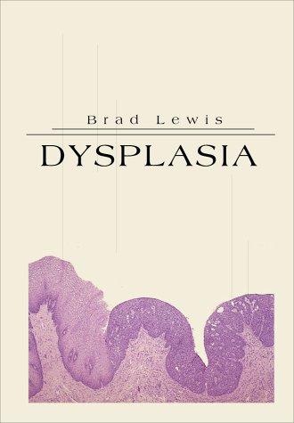 Dysplasia