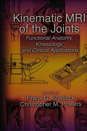 Kinematic MRI of the Joints