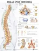 Human Spine Disorders Anatomical Chart