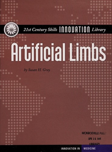 Artificial Limbs