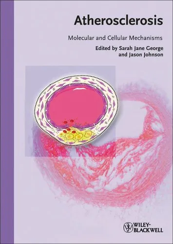 Atherosclerosis : Molecular and Cellular Mechanisms