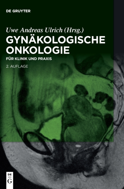 Gynakologische Onkologie