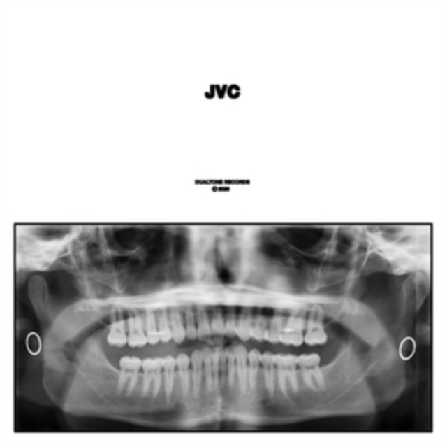 JVC