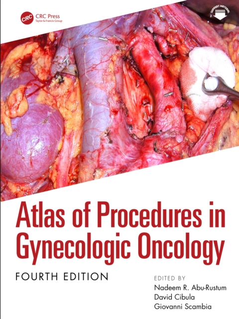Atlas of Procedures in Gynecologic Oncology