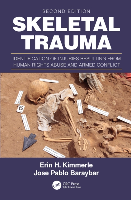 Skeletal Trauma