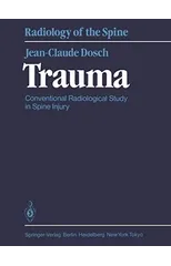 Trauma
