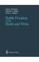 Stable Fixation of the Hand and Wrist