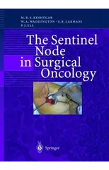The Sentinel Node in Surgical Oncology