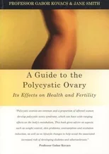 A Guide to the Polycystic Ovary