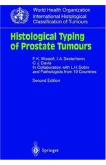 Histological Typing of Prostate Tumours