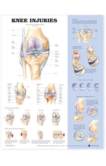 Knee Injuries Anatomical Chart