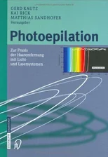 Photoepilation