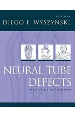 Neural Tube Defects