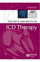 The Nuts and Bolts of ICD Therapy