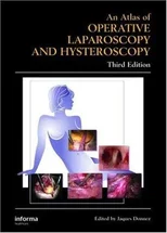 Atlas of Operative Laparoscopy and Hysteroscopy