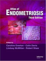 Atlas of Endometriosis