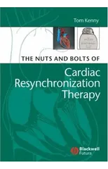 The Nuts and Bolts of Cardiac Resynchronization Therapy