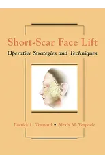 Short-Scar Face Lift