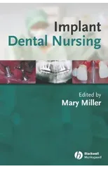 Implant Dental Nursing