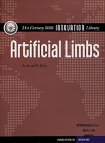 Artificial Limbs