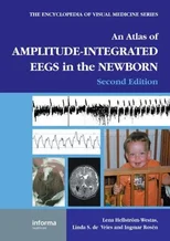 An Atlas of Amplitude-Integrated EEGs in the Newborn