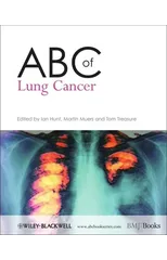 ABC of Lung Cancer