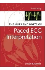 The Nuts and bolts of Paced ECG Interpretation