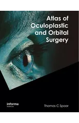 Atlas of Oculoplastic and Orbital Surgery