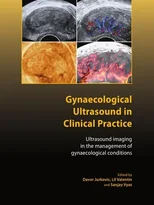Gynaecological Ultrasound in Clinical Practice
