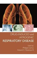Drug-induced and Iatrogenic Respiratory Disease