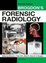 Brogdon's Forensic Radiology