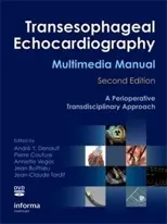 Transesophageal Echocardiography Multimedia Manual