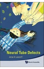 Neural Tube Defects