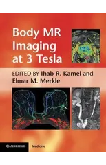 Body MR Imaging at 3 Tesla