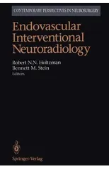 Endovascular Interventional Neuroradiology