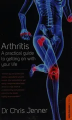 Arthritis