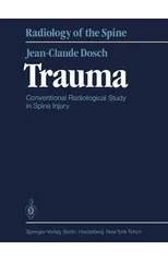 Trauma