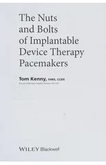 The Nuts and Bolts of Implantable Device Therapy