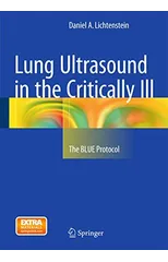 Lung Ultrasound in the Critically Ill