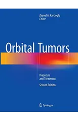 Orbital Tumors