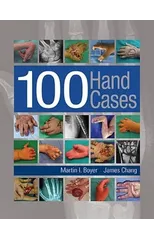 100 Hand Cases