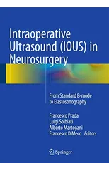 Intraoperative Ultrasound (IOUS) in Neurosurgery