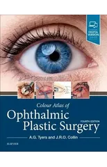 Colour Atlas of Ophthalmic Plastic Surgery