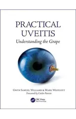Practical Uveitis
