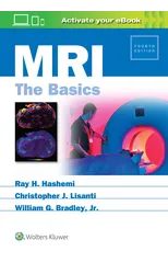 MRI