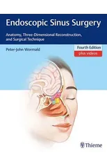 Endoscopic Sinus Surgery