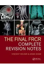 The Final FRCR