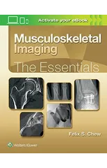 Musculoskeletal Imaging