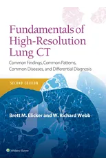 Fundamentals of High-Resolution Lung CT